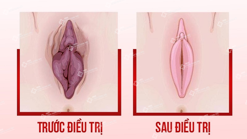 tan-trang-co-be