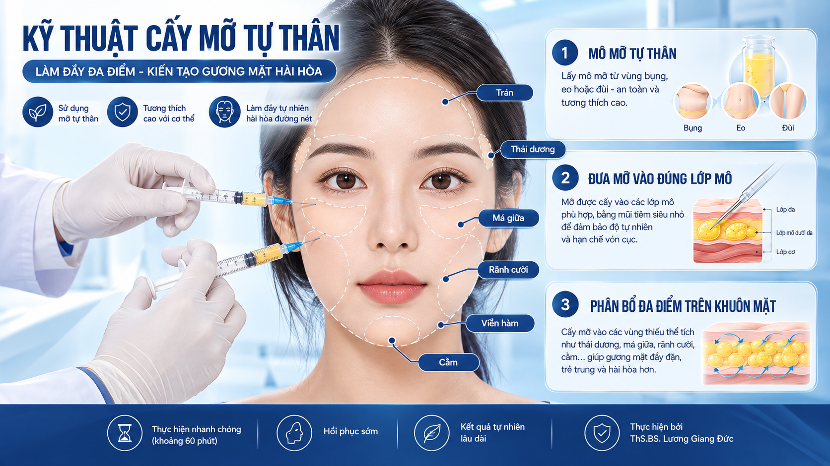 Mô phỏng kỹ thuật cấy mỡ tự thân trên khuôn mặt và các lớp mô dưới da. Cấy mỡ tự thân an toàn