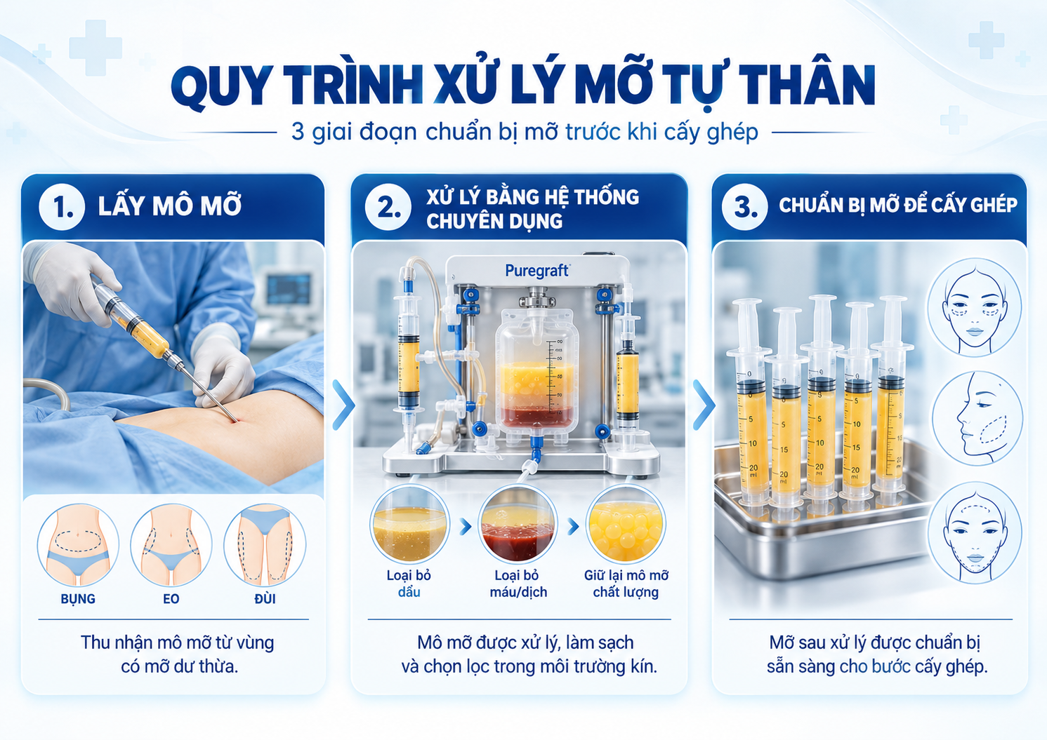 Cấy mỡ mặt ở đâu tốt: Quy trình xử lý mô mỡ bằng hệ thống chuyên dụng trước khi thực hiện cấy mỡ tự thân vùng mặt